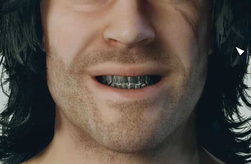 HD Teeth
