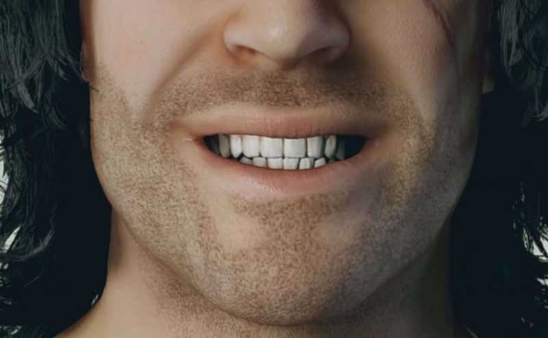 HD Teeth