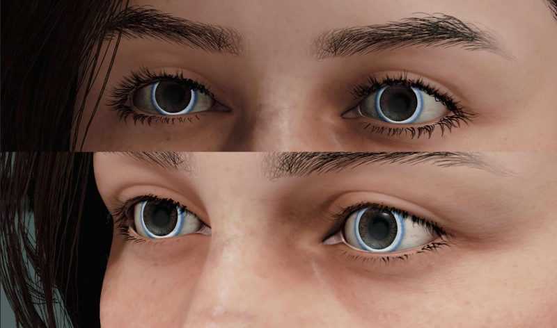 Less Severe Eyelashes